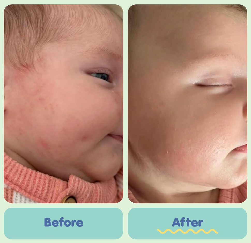 Baby Skin Ointment