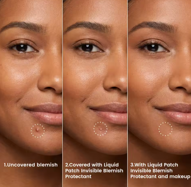 Invisible Liquid Blemish Patch for Pimples Cover