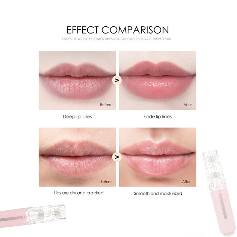 2-in-1 Lip Roller