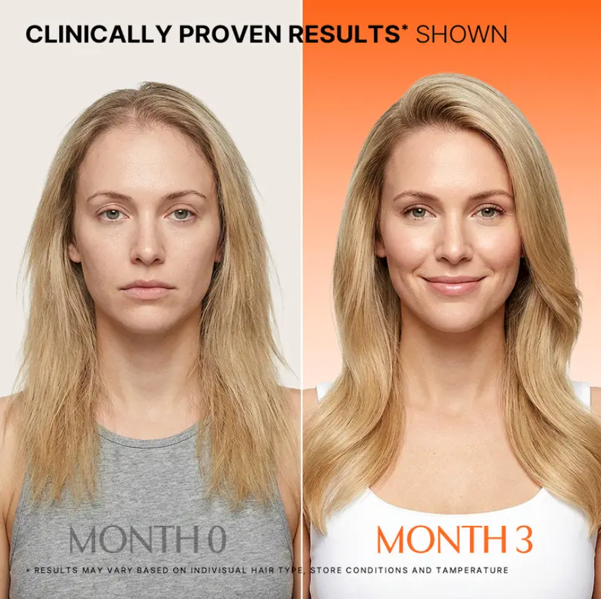 Hair Growth Serum with Built-in Brush