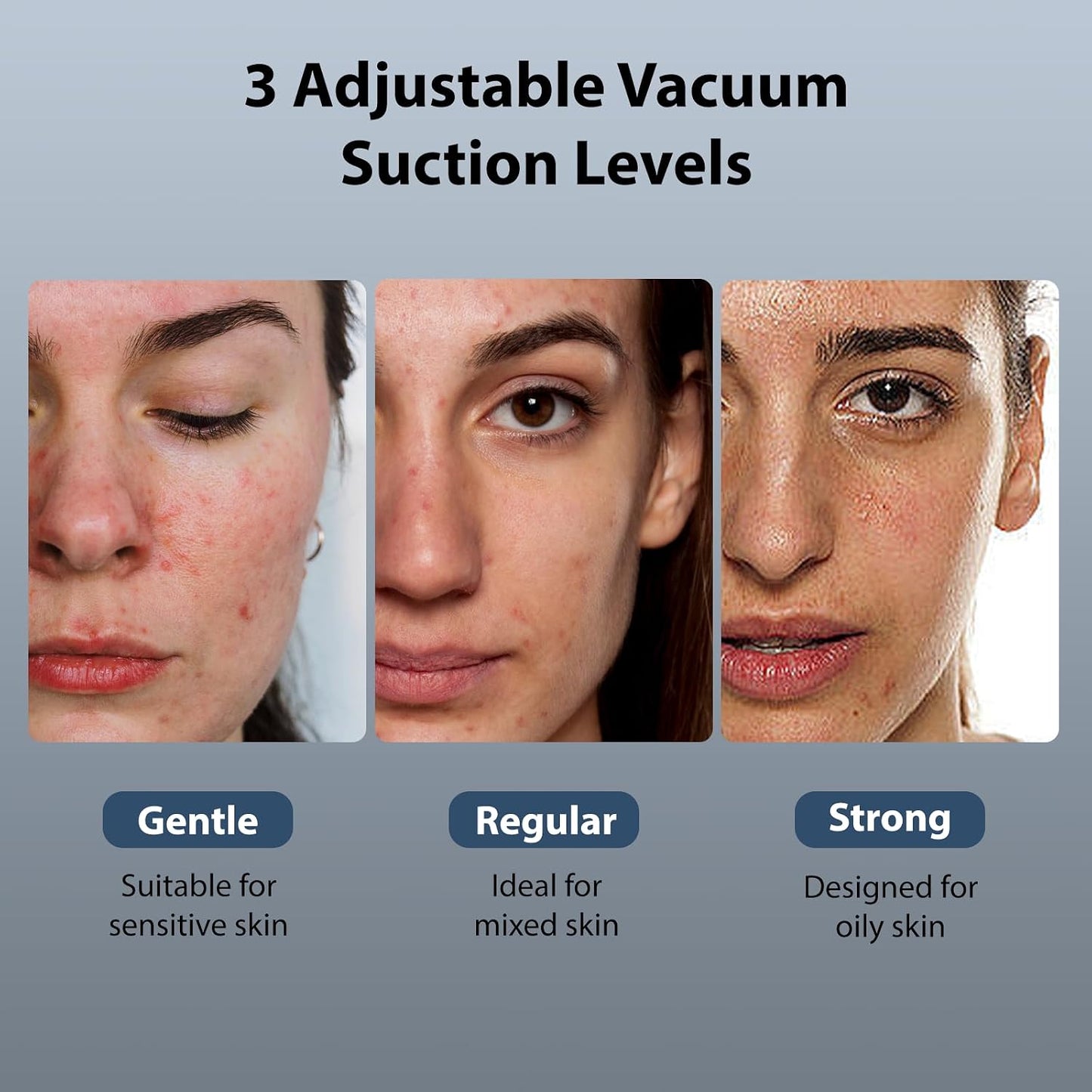Hydra Facial Blackhead Removal Kit